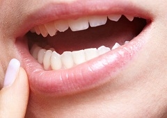 Najčešće zubne (i usne) bolesti