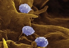 Chlamydia trachomatis (Klamidija)